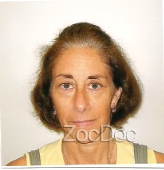 Elaine Hriston-Zech, PT